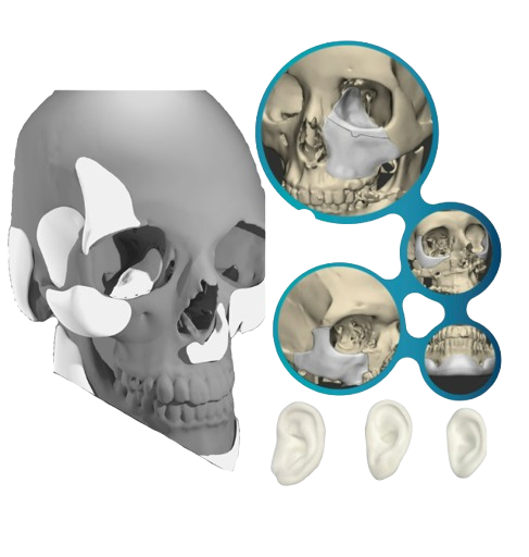 Stereolithography